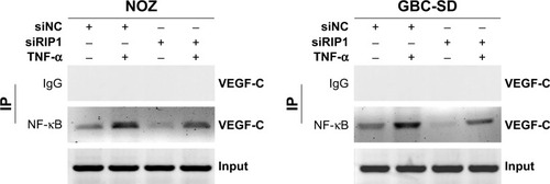 Figure 5 Knockdown of RIP1 impaired the TNF-α-enhanced association of NF-κB with the VEGF-C promoter region.