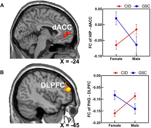 Figure 3 The interactive effect of diagnosis × gender on the right hippocampus functional connectivity network (A) and right parahippocampal gyrus functional connectivity network (B).