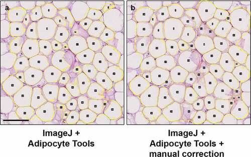 Figure 3. ImageJ plugin Adipocyte Tools rendered fat cell detections (a) can be manually corrected (b) if necessary, effectively resulting in delineation of cells equivalent to full manual detection. With the QuPath protocol, there are similar options. Scale bar 200 µm.
