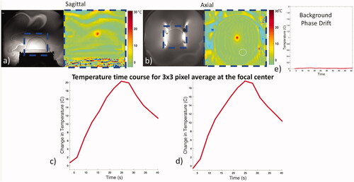Figure 9. Coil performance during thermal heating. Magnitude (a, b left) and combined phase difference temperature maps (a, b right) for sonications in the sagittal and axial planes. Heating is restricted to the focus and follows a typical heating rise-decay curve (c, d). Minimal background phase variation was observed using an ROI away from the focal spot (white circle) over time (e).