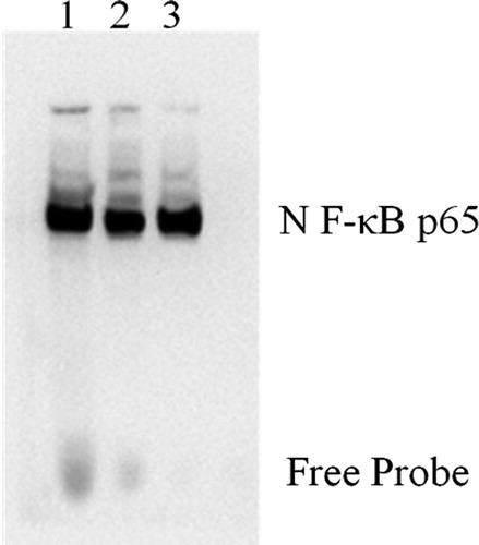 Figure 5. NF-κB activity in KM3 cells under various culture conditions as assessed by EMSA. (1) KM3/MM-BMSC co-culture group, (2) KM3/hUCBDSC co-culture group, (3) KM3 group. After sub-culture for 4 days, KM3 cells from the three groups were collected, and NF-κB activity in KM3 cells was assessed by EMSA. NF-κB DNA-binding activity in KM3 cells was decreased in the KM3/hUCBDSC group, while the level of NF-κB DNA-binding activity was elevated in the KM3/MM-BMSC group. Each experiment was performed three times. hUCBDSCs, human umbilical cord blood-derived stromal cells; MM-BMSCs, multiple myeloma bone marrow stromal cells; NF-κB, nuclear factor kappa B; EMSA, electrophoretic mobility shift assay.