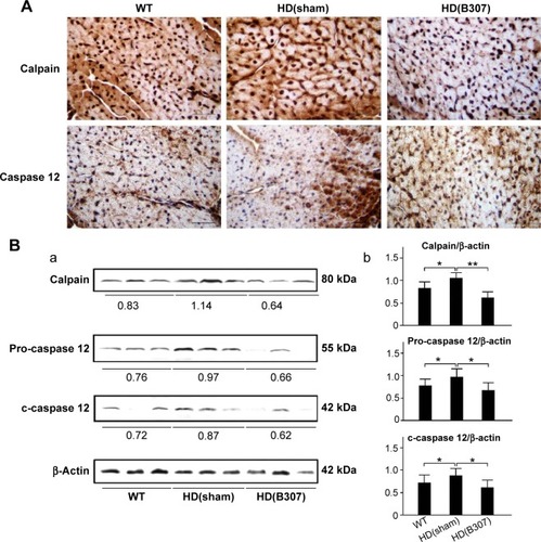 Figure 7 Expressions of calpain and caspase 12, two markers of ER stress-related apoptosis, in the heart tissue of R6/2 HD mice under oral B307 treatment, and of their WT.Notes: (A) IHC staining illustrates that expressions of calpain and caspase 12 (shown in brown) were remarkable in comparison to their WT but were reduced under oral B307 treatment. Scale bars: 25 μm. (B) Western blotting analysis shows the following: (a) Cardiac expression levels of calpain and caspase 12 in R6/2 HD mice under sham and oral B307 treatments, and of their WT. (b) Quantified cardiac calpain and caspase 12 levels in R6/2 HD mice were significantly enhanced in comparison to their WT but were significantly weaker under oral B307 treatment. There were six mice per each group. Values are mean ± SEM (**P<0.01, *P<0.05, two-way ANOVA followed by a Student–Newman–Keuls multiple comparisons posttest).Abbreviations: WT, wild-type littermate controls; HD, Huntington’s disease; ER, endoplasmic reticulum; IHC, immunohistochemical; SEM, standard error of the mean; ANOVA, analysis of variance.