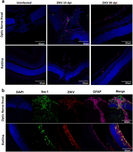 Fig. 6 Inflammation and cellular infiltration in ZIKV infected eyes 15 and 30 dpi.a Infiltration of CD4 and CD11c + cells 15 and 30 dpi. Staining with DAPI (blue), anti-CD4 (red), anti-CD11c (green). b ZIKV colocalizes with microglia 15 dpi. Staining with DAPI (blue), Iba-1 (green), EVU-302 (red), GFAP (magenta) shows virus and Iba+ microglia are evident in the optic nerve and retina. Note colocalization of Iba-1 and EVU-302 and gliosis of surrounding area. Figure representative of three mice/time point with similar images