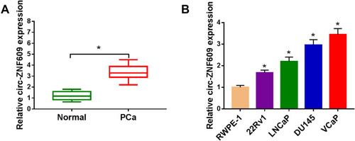 Figure 1 Circ-ZNF609 is highly expressed in PCa. (A) The level of circ-ZNF609 was examined in PCa tissues and matching non-tumor tissues by qRT-PCR. (B) qRT-PCR was applied to detect the level of circ-ZNF609 in normal human prostate epithelial cell line and a panel of four PCa cell lines. *P<0.05.