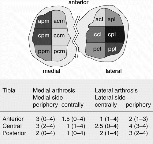 Figure 6. Grading of cartilage destruction/ bone attrition in medial and lateral arthrosis of the tibia plateau. Median values and range. Template used to separate the 6 different areas on the tibia plateau is illustrated above. The darker the area the more pronounced the degenerative changes observed (median value). a = anterior, c = central, p = posterior in first position, peripheral in second position, m = medial, l = lateral.