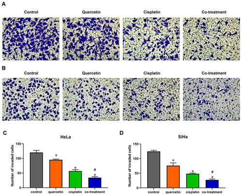 Figure 4 Quercetin promoted the effect of cisplatin on the invasion of cervical cancer cells. HeLa (A) and SiHa (B) cells were treated with control (complete culture medium), quercetin (15 μM for HeLa and 30 μM for SiHa), cisplatin (10 μM for HeLa and 12 μM for SiHa) or the co-treatment of quercetin and cisplatin. The bars represent the ratios of the invaded cell numbers in each group. Data of HeLa (C) and SiHa (D) are expressed as means ± SD deviation of three independent experiments. *P < 0.05 vs control group, #P < 0.05 vs cisplatin group.