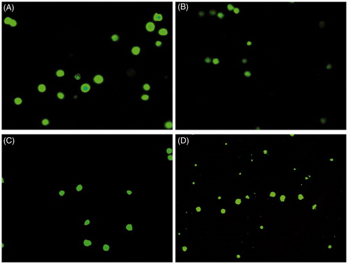 Figure 5. Cellular morphological analysis and apoptosis detection in HT29 cancer cells on treatment with zinc oxide nanoparticles by acridine orange staining and fluorescent microscopy. Control (A), 5 μg/ml (B), 20 μg/ml (C) and 50 μg/ml (D) of ZnO nanoparticle treatment.
