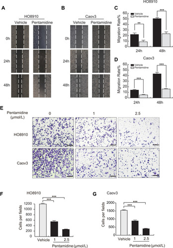 Figure 2 Pentamidine suppresses the migration of OC cells. (A and B) Wound-healing assay was performed with DMSO control and pentamidine-treated HO8910 and Caov3 cells. Representative images were obtained at 2.5 μmol/L for the indicated time. (C and D) Quantification of wounding-healing assay. Data are represented as mean ± SD from three independent experiments. Significance was determined by Student’s t-test. **P<0.01; ***P<0.001. (E) Transwell migration experiments of HO8910 and Caov3 cells were performed at the indicated concentrations for 6 h and representative images were photographed. Scar bars: 100μm. (F and G) The numbers of migrating cells were counted and analyzed. Data are represented as mean ± SD from three independent experiments. Significance was determined by one-way ANOVA. ***P<0.001.