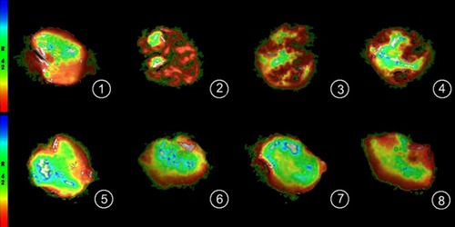 Figure 9 T2* mapping shows effect of ultrasmall superparamagnetic iron oxide (USPIO)–polyethylene glycol (PEG)–Sialyl Lewis X (sLeX) contrast agent on images of primary tumors in footpads.Notes: Color scale used for magnetic resonance imaging (MRI) signal-intensity mapping with software. Top row, T2* mapping of metastasis group at t0, t1, t2, and t3. Bottom row, T2* mapping of control group at t0, t1, t2, and t3. In both mice, USPIO-PEG-sLex was administered via the tail vein.