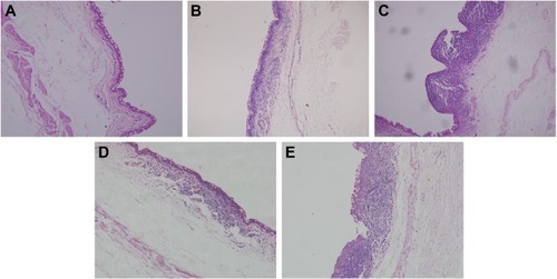 Figure 13 Conjunctival histopathology by microscopy.Notes: (A) Normal cornea, (B) treated with saline, (C) treated with Betoptic, (D) treated with BH solution, and (E) treated with Mt-BH-LPs.Abbreviations: Mt-BH-LPs, montmorillonite–betaxolol hydrochloride liposomes; BH, betaxolol hydrochloride.