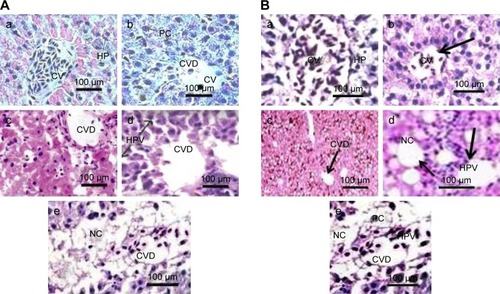 Figure 8 (A) Photomicrographs of the histology (H&E staining, 1,000×) of livers in Sprague Dawley rats exposed to uncoated gold nanoparticles. (a) Negative control (CV: central vein, HP: hepatocytes); (b) liver exposed to12.5 µg/kg (CV: central vein, CVD: damage to the central vein, PC: pycknotic); (c) liver exposed to 25 µg/kg (CVD: damage to the central vein, HPV: vacuolation in hepatocytes); (d) liver exposed to 50 µg/kg (CVD: damage to the central vein, HPV: vacuolation in hepatocytes), and (e) liver exposed to 100 µg/kg (CVD: damage to the central vein, NC: necrosis). Mean values and standard deviations of ten values represent each point. (B) Histological photomicrographs (H&E staining, 1,000×) of the livers of Sprague Dawley rats exposed to PEG-coated gold nanoparticles. (a) Negative control (CV: central vein, HP: hepatocytes); (b) liver exposed to 12.5 µg/kg (CV: central vein); (c) liver exposed to 25 µg/kg (CVD: damage to the central vein); (d) liver exposed to 50 µg/kg (HPV: vacuolation in hepatocytes, NC: necrosis), and (e) liver exposed to 100 µg/kg (CVD: damage to the central vein, HPV: vacuolation in hepatocytes, NC: necrosis, PC: pyknotic). Mean values and standard deviations of ten values represents each point.Note: Arrows indicate particular damage in the specimen.