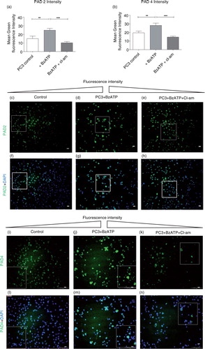 Fig. 3.  Increased expression of PAD2 and PAD4 upon microvesiculation is inhibited by chloramidine. Mean green fluorescence intensity [for PAD2 (a) and PAD4 (b)], as determined using Cell∧M imaging software on fluorescent microscopy images [panels (c–e) and (i–k)], respectively, indicates increased expression of PAD2 and 4 during BzATP stimulation of MV release. These values were obtained from PC3 cells preseeded on coverslips and pretreated with 10 µM Cl-am (e, h, k, n) or without Cl-am (d, g, j, m) for 30 min at 37°C. The cells were then washed and incubated at 37°C for 30 min in the presence (d, e, g, h and j, k, m, n) or absence (c, f, i, l) of 300 µM BzATP. (d, g, j, m) PAD2 and PAD4 (green) expression in PC3 cells are increased in response to stimulation of MV release (BzATP treatment) and reduced upon Cl-am treatment (e, h, k, n). (f–h) and (l–n) represent merged images of (c–e) and (i–k) respectively with nuclear (DAPI) staining. Scale bars – 100 µm, white bar, 20 µm.