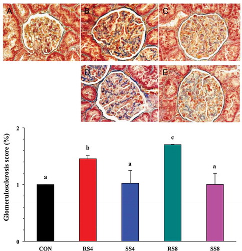 Figure 4. Effect of high-salt diet on kidney histopathology as revealed by Masson’s trichrome staining in the glomerular capsule and tufts (400× magnification). (a): CON, no fibrosis. (b): RS4, moderate fibrosis (arrows). (c): RS8, severe fibrosis (arrows). (d): SS4, and (e): SS8, very mild fibrosis (arrows). Graph on the bottom shows quantitative representation of renal injury in the kidneys of Dahl salt sensitive rats fed the different diets for 15 weeks. Glomerulosclerosis index for each rat was used to estimate the renal damage. Values are presented as mean ± SEM. Labelled means without a common letter differ significantly at P < 0.05.