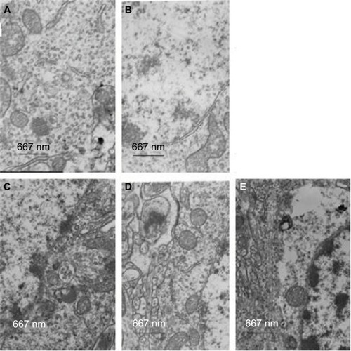 Figure 3 Mitochondrial histomorphology in the corpus striatums of five groups at day 14 by transmission electron microscopy.