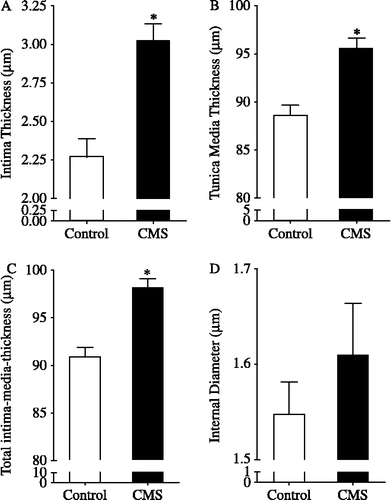 Figure 2 Intima (A), tunica media (B), total intima-media (C) thickness and internal diameter (D) of thoracic aortas isolated from rats submitted to chronic mild stress (CMS), 15 days after the stress protocol, and controls (n = 5/group). *p < 0.05 vs. control group. The values are expressed as means ± SEM.