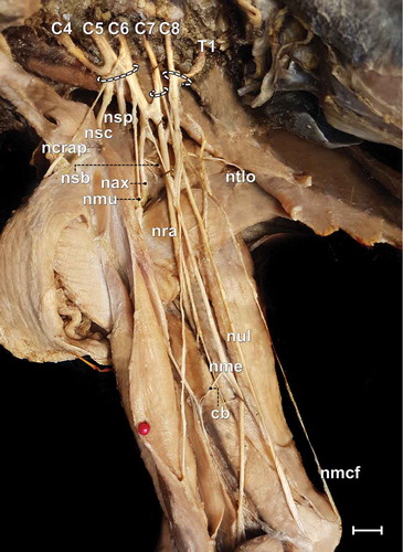 Figure 1. Photomacrograph of the axillary region and medial brachial surface of a male adult specimen of Alouatta guariba clamitans evidencing the constitution of the brachial plexus and its cranial (C4, C5 and C6), medium (C7) and caudal (C8 and T1) trunks. cb = communicating branch; nax = axillary nerve; ncrap = cranial pectoral nerve; nmu = musculocutaneous nerve; nmcf = medial cutaneous of the forearm nerve; nme = median nerve; nsb = subscapularis nerve; nsc = subclavius nerve; nsp = suprascapularis nerve; nra = radial nerve; ntlo = long thoracic nerve; nul = ulnar nerve. Scale bar: 10 mm.