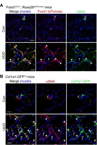 Figure 2 Renal pericytes are the origin of scar-producing myofibroblasts in fibrotic kidney.