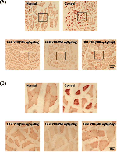 Figure 2.  GGEx18 inhibits high fat diet–induced increases in lipid accumulation in skeletal muscle of C57BL/6J mice. Adult male C57BL/6J mice were fed a low-fat diet (normal), a high-fat diet (control), or the high-fat diet supplemented with 125, 250, and 500 mg/kg/day for 9 weeks. (A) Histology showing transverse sections of skeletal muscle. (B) Higher magnitude of bracket area from (A). Shown are representative oil red O-stained sections (7-μm thick) of skeletal muscle. The number and intensity of stained fibers in the GGEx18 group were much less than that in the control group. Normal, low fat diet-fed mice; control, high fat diet-fed mice; GGEx18, GGEx18-treated high fat diet-fed mice.