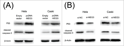 Figure 5. P53 and cleaved caspase 3 protein levels after the transfection. (A) P53 and cleaved caspase 3 protein levels was increased in HeLa and CaSki cell after the transfection of the pcDNA- MEG3. (B) P53 and cleaved caspase 3 protein levels was decreased after the transfection of the si- MEG3.