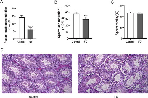 Figure 1. Folic acid deficiency affected the sperm concentration of mice and the histopathology of the testis. (A) plasma folic acid concentration (B) Sperm concentration (C) Sperm motility (D) HE staining of the testes of the control group and the folic acid deficiency group. All experiments were performed n = 6 in replicates. Data were presented as mean ± SEM. ***P < 0.001, ****P < 0.0001