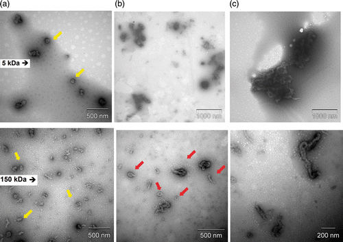 Figure 5. (Colour online) TEM images of CH 150 Kda DNA nanoparticles synthesised at pH 6.3 and at varying ionic strengths: (a) 10 mM (b) 150 mM and (c) 500 mM at N/P ratio 7.0.