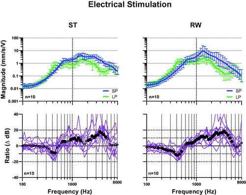 Figure 3. Mean transfer functions (upper plots) of electromechanical stimulation for SP- and LP-coupling and ratio between SP- and LP-coupling (lower plots) on the stapes (ST, left plots) and round window (RW, right plots). Error bars: confidence interval; Dots: means. Significant difference (p < 0.05) between SP and LP couplers are marked with filled dots.