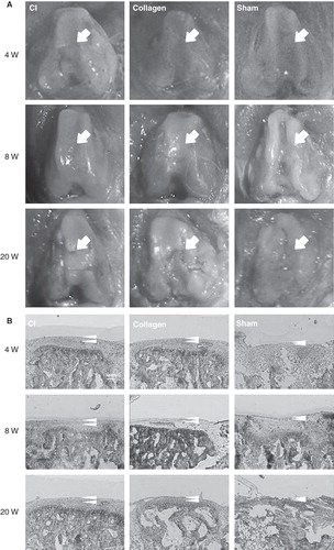 Figure 3. Macroscopic and histological evaluation at weeks 4, 8, and 20. A: Macroscopic assessment showing a better recovery as judged by a relatively smooth surface of the articular cartilage in the CI group compared to the other groups at weeks 4 and 8. In contrast, there was no apparent difference in the thickness of the articular cartilage between the three groups at week 20. Arrows indicate the defect area. B:Histological assessment with toluidine blue staining showing that the thickness of the articular cartilage was higher in the CI group than in the other groups at weeks 4, 8, and 20. However, at week 20, the thickness of the articular cartilage was decreasing in all groups. Arrow heads indicate the thickness of the articular cartilage.