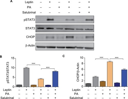 Figure 3 Salubrinal promotes hypothalamic leptin sensitivity by inhibiting PA-induced ER stress response.