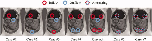 Figure 3. Visual representation of the inflow and outflow placement described in Table 1.