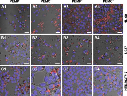 Figure 6 Detection of late apoptotic signaling by Hoechst staining analyzed with CLSM after a co-incubation time of 24 h for different cell types (A: HL-60 cells, B: U937 cells and C: HEK293T cells) with LbL-microparticles (columns 1 and 3) and LbL-microcapsules (columns 2 and 4) with negative (columns 1 and 2) and positive (columns 3 and 4) surface charge.Note: Scale bars: 20 µm.Abbreviations: CLSM, confocal laser scanning microscopy; LbL, layer-by-layer; PEMCs, polyelectrolyte-coated microcapsules; PEMPs, polyelectrolyte-coated microparticles.