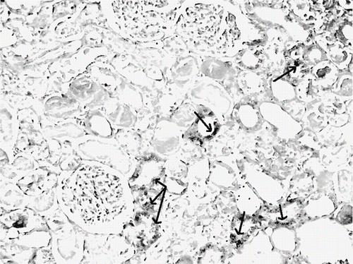 Figure 9. Iron-stained kidney section of a glycerol+vitamin C-treated rat (ARF-VC group). The level of granular deposits (arrow), showing iron accumulation, decreased compared with the ARF group (iron statin × 100).