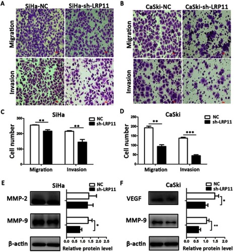 Figure 7 Effect of LRP11 on migration and invasion of SiHa and CaSki cells. (A and B) Silencing LRP11 in SiHa and CaSki cells resulted in decreased migration and invasion. (C and D) Quantification of the images of A and B. (E and F) Western blotting was performed to identify the protein levels of MMP-2, MMP-9 and VEGF after the silencing LRP11 in the SiHa and CaSki cells; *P<0.05, **P<0.01, ***P<0.001 compared with the NC groups.