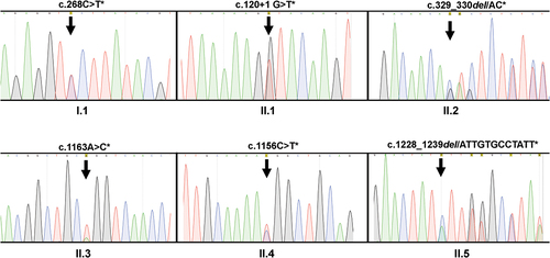 Figure 2. DNA sequencing analysis of individuals with type I (n = 1) and type II (n = 5) CD36 deficiency. Genomic DNA was isolated and subjected to polymerase chain reaction (PCR) amplification using two primer pairs mentioned in the methods were subsequently analyzed using nucleotide sequencing. The heterozygous mutations (*) detected in the type I individual (I.1) and five type II individuals (II.1–5) are shown. The position of the mutations/deletions are indicated by arrows.