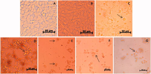 Figure 10. (A–G) Dose dependent effect of AgNPs on the morphology of HeLa cells. In the order: Control (A), vehicle control (B), positive control (C), 2 μg/mL (D), 4 μg/mL (E), 6 μg/mL (F), 8 μg/mL and (G) AgNPs treated cells, respectively. Magnification: 40×. Arrows represent dead cells and apoptotic features such as echinoid processes, cell shrinkage and nuclear condensation.