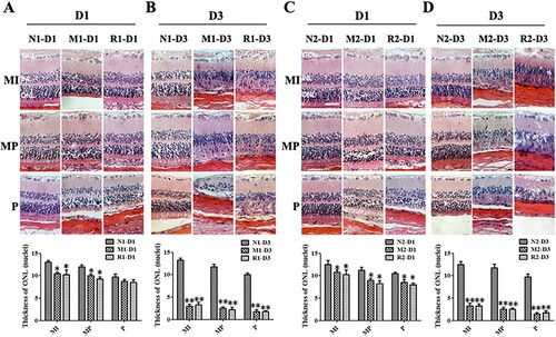 Figure 3. RSV-induced effect on retinal histology in MNU-treated retinas. A, B: Typical images of HE staining of retinal sections of rats with RSV intervention of the first mode and plot of nuclei counts of ONL layer at 1 d (A) and 3 d (B) after MNU administration; A, B: Typical images of HE staining of retinal sections of rats with RSV intervention of the first mode and plot of nuclei counts of ONL layer at 1 d (A) and 3 d (B) after MNU administration. C, D: Typical images of HE staining of retinal sections of rats with REV intervention of the second mode and plot of nuclei counts of ONL layer at1 d (A) and 3 d (B) after MNU administration. (n = 3; MI: the middle area of the retina; MP: the mid-peripheral area of the retina; P: the peripheral area of the retina; ONL: outer nuclear layer; INL: inner nuclear layer; GCL: ganglion cell layer; Scale: 50 μm; *P < 0.05, **P < 0.01: vs. N group).