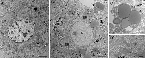 Figure 7 TEM images of liver from control (A) and SLN-treated (B–D) mice. Note the high number of lipid droplets (L) in the hepatocytes of SLN-treated mouse. Some lipid droplets showing a finely granular electron-dense border are extruded from the cell (arrow in (B); high magnification in (C). In addition, the hepatocyte in (B) shows a loosened appearance, with euchromatic nucleus (N), dispersed glycogen clusters (asterisks) and rough endoplasmic reticulum cisternae (ER) arranged in a less orderly pattern (D) in comparison to control (A). Bars 2500 nm (A, B); 1000 nm (C, D).