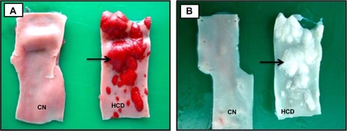 Figure 9 Photographs show aortic arch of CN and HCD groups.