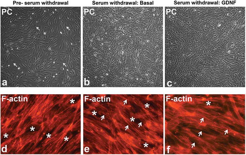 Figure 1. GDNF-mediated human BNB morphological changes following serum withdrawal. Representative phase contrast digital photomicrographs of visually confluent pHEndECs in vitro following initial seeding and culture in regular growth medium (A) and following serum withdrawal in basal medium (B) and basal medium containing 1 ng/mL GDNF (C) demonstrate an admixture of proliferating cuboidal-shaped (white arrows) and spindle-shaped cells prior to serum withdrawal. Diffuse spindle-shaped endothelial cells are characteristic following serum withdrawal, with endothelial layers appearing more organized 48 hours afterwards in the presence of GDNF (C) compared to basal conditions (B). Intercellular gaps (white asterisk) and more cuboidal cells with larger cytoplasm and more diffuse intracytoplasmic F-actin cytoskeletal filaments are more commonly seen prior to serum withdrawal (D). Spindle-shaped cells with more F-actin localization at intercellular membranes (white arrows) are more prevalent following serum withdrawal (E, F) with fewer intercellular gaps (white asterisk) seen following GDNF treatment 48 hours afterwards. PC = Phase Contrast. Initial magnification 100X (A-C) and 400X (D-F).