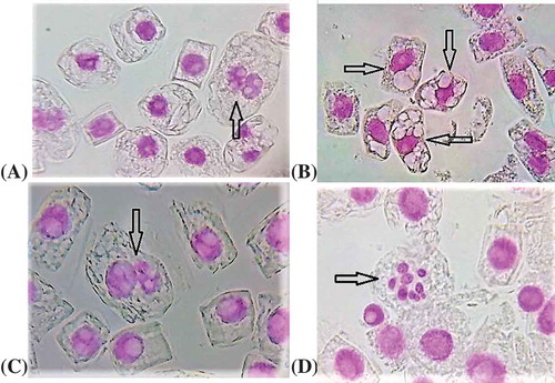 Figure 3. Some interphase nuclear anomalies induced by exposure to different concentration of urea in meristematic tissues of Allium cepa: (a) binucleated cells; (b) multinucleated cells with ghost nuclei; (c) cell with three micronuclei; (d) cell with nine micronuclei.