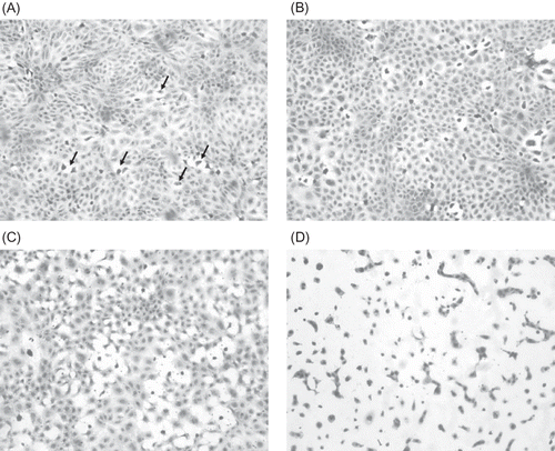 Figure 1. (A) Hematoxylin-stained NRK 52-E cells (control – incubation media treated) (×200). Note the confluence of the cell layer. Randomly scattered throughout the culture are cells that have separated from the surrounding cells and contain condense dark nuclei (arrows). These are degenerating/dying cells. (B) Hematoxylin-stained NRK 52-E cells after 1 h exposure to 150 mg I/mL ioversol (×400). Note the increased number of dead cells scattered throughout the cell culture layer. (C) Hematoxylin-stained NRK 52-E cells after 3 h exposure to 150 mg I/mL ioversol (×400). There are more necrotic cells and the confluence of the cell culture layer is lost. (D) Hematoxylin-stained NRK 52-E cells after 12 h exposure to 150 mg I/mL ioversol (×400). Note that almost all the cells are either necrotic or dying. Also cell-to-cell contact is minimal.