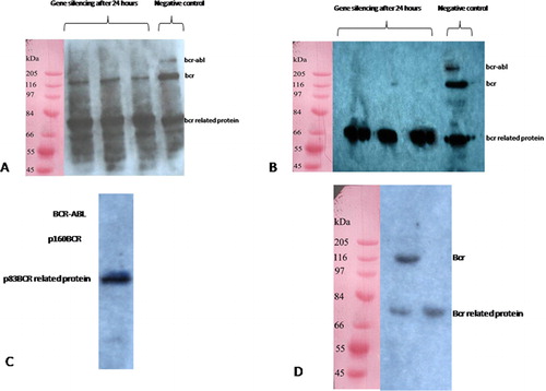 Figure 6. (A) Western blotting 24 hours following 2 μM/ml Morpholino Oligo Antisens treatment showing that p210bcr-abl suppressed and the level of p160bcr became weaker, (B) by 48 hours, bond of p210bcr-abl and p160bcr was not observed. The expression of p83bcr-related protein was considered as internal control group. (C) In the case of K562 treated with 5 μM/ml Morpholino, no p210bcr-abl and p160bcr band was detected after 24 hours. (D) Jurkat, the control group included cells treated with 2 μM/ml Morpholino.