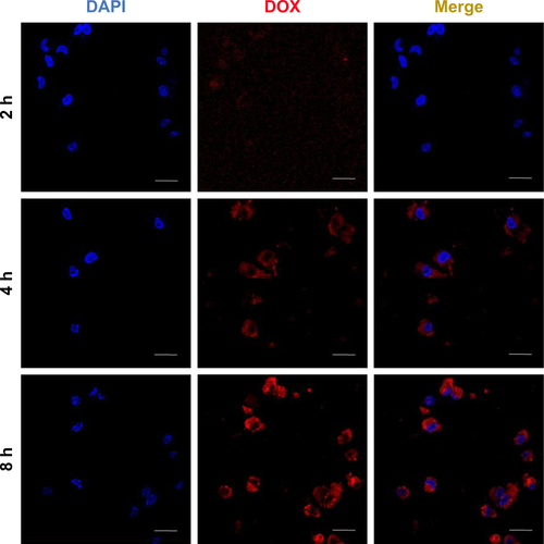 Figure S2 Confocal microscopic images of the intracellular DOX localization of MCF-7/ADR cells treated with DOX@SUR nanoparticles at a DOX concentration of 5 μg/mL for different time courses.Note: Scale bar: 25 μm.Abbreviations: DAPI, 4,6-diamidino-2-phenylindole; DOX, doxorubicin; SUR, surfactin; DOX@SUR, DOX-loaded surfactin.