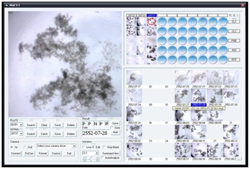 Figure 3 Daily reading and recording using digital microscope and software.