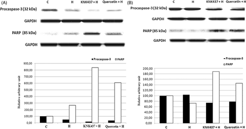 Figure 5. The effects of hyperthermia, KNK437 and quercetin on proteolytic cleavage of PARP and activation of caspase-3 in PC-3 (A) and LNCaP (B) cells determined by western blot. Cells were preincubated and treated with drugs and hyperthermia as described in Figure 2. The cells were washed and disrupted by the addition of lysis buffer containing protease inhibitor cocktail tablet at 4°C and 24 h after hyperthermia and drug treatments of cells. They were then centrifuged at 10,000 g for 30 min at 4°C. Proteins were separated in a 10% (for cleaved-PARP) and 15% (for procaspase-3) SDS-polyacrylamide gel and electroblotted to nitrocellulose membrane. The immunoblotting of cleaved PARP (85 kDa apoptosis related cleavage fragment) and procaspase-3 (32 kDa anticaspase-3 antibody detects inactive form) is shown. Blots are representative. Graph shows the mean ± SD of band intensities (relative arbitrary unit) of three experiments.