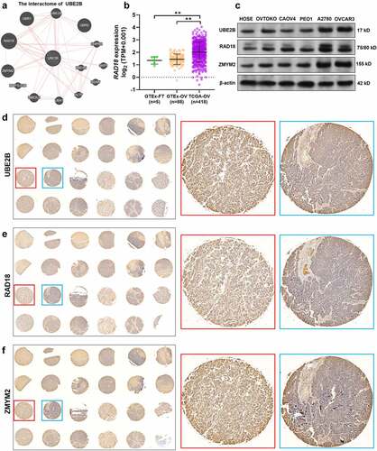 Figure 2. UBE2B and RAD18 expression are positively correlated with ZMYM2 protein levels in ovarian tumor tissues. (a) Proteins with potential interactions with UBE2B. The prediction was conducted using GeneMANIA. (b) The expression of RAD18 in the normal fallopian tube (GTEx-FT, n = 5) and ovary tissues (n = 88) (GTEx-OV) and ovarian cancer tissues in TCGA-OV (n = 418). (c) The expression of UBE2B, RAD18, and ZMYM2 in multiple ovarian cancer cell lines (OVTOKO, CAOV4, PEO1, A2780, and OVCAR3) and normal HOSE cells. (d-f) IHC staining images of UBE2B (d), RAD18 (e), and ZMYM2 (f) in 24 ovarian cancer tissues. Representative images of high (red frames) and low (blue frames) protein expression were provided in the right panels. **, p < 0.01.