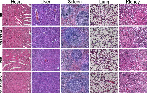 Figure 7. Tissue toxicity assessment. Representative images of H&E staining of heart, liver, spleen, lung, and kidney in each group (×200).