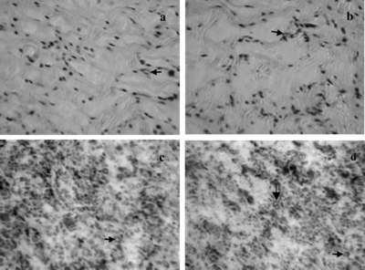 Figure 4 Histology and immnohitochemistry of equivalents at the second week after grafting into rats. A) H + E staining of DE, microvessel-like tubes were observed (arrow). B) H + E staining of EDE, microvessel-like tubes were observed (arrow). C) CD31 staining of DE, microvessel-like tubes not stained with antihuman CD31 antibody were seen (arrow). D) CD31 staining of EDE, microvessel-like tubes formed by HUVEC in EDE still persisted, and rat microvessel, not stained with antihuman CD31 antibody (horizontal arrows), were seen (original magnification × 250).