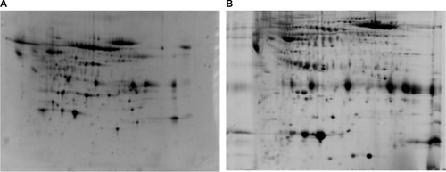 Figure 1 Images of CSF before and after albumin/IgG removal.