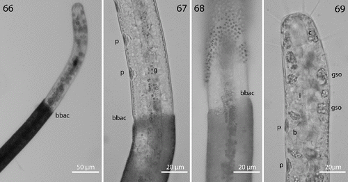 Figs. 66–69. Robbea agricola sp. nov. 66. Anterior body region and beginning of bacterial coat; 67. Beginning of bacterial coat, detail; 68. Large cocci on anterior body region; 69. Glandular sensory organs. LM of live animals.