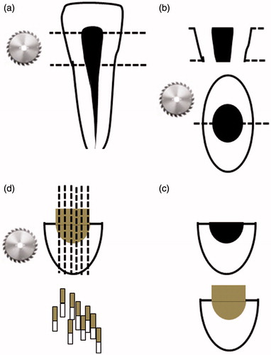 Figure 1. Schematic presentation of specimen preparation for microtensile bond strength test for bonding to bovine pulp chamber dentin surfaces. (a) two subsequent sections, which were perpendicular to long axis of tooth, were performed using low speed diamond saw under water cooling. The first section was performed at 5 mm above enamel–cement border; the other one was performed at 1 mm under enamel–cement border. (b) The obtained crown segments with 6 mm heights were sectioned into halves using low speed diamond saw. Then, pulp chamber dentin surfaces in order to bond were exposed. (c) Following application of adhesives, composite buildups were done incrementally. (d) Bonded specimens were sectioned serially to obtain resin–dentin sticks to be used for microtensile bond strength test.
